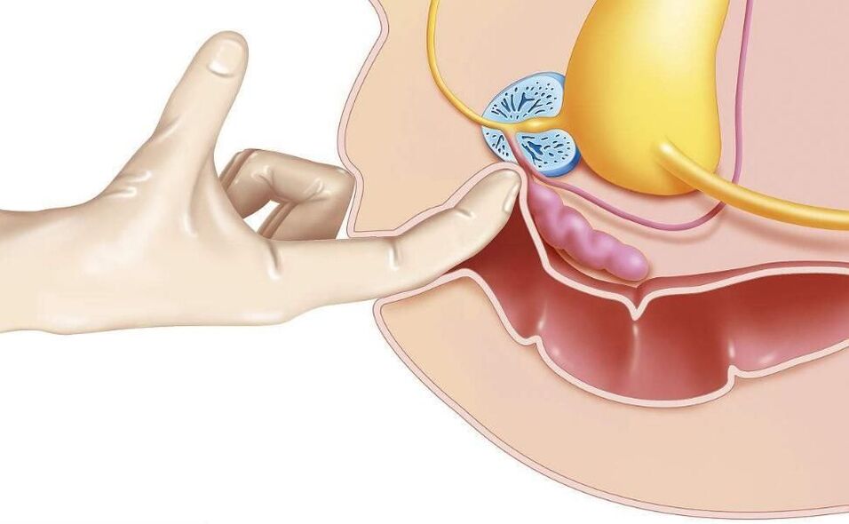 prostatic massage