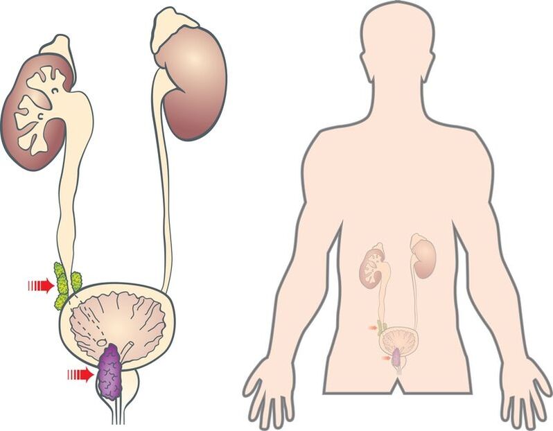 Symptoms and causes of prostatic adenoma